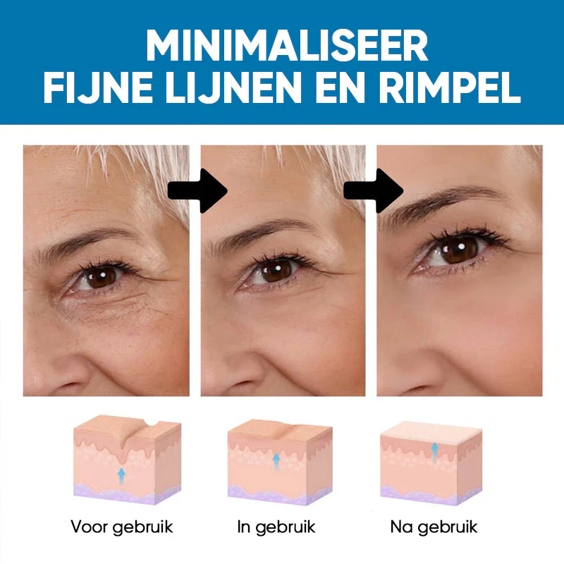 Miniatuur 10